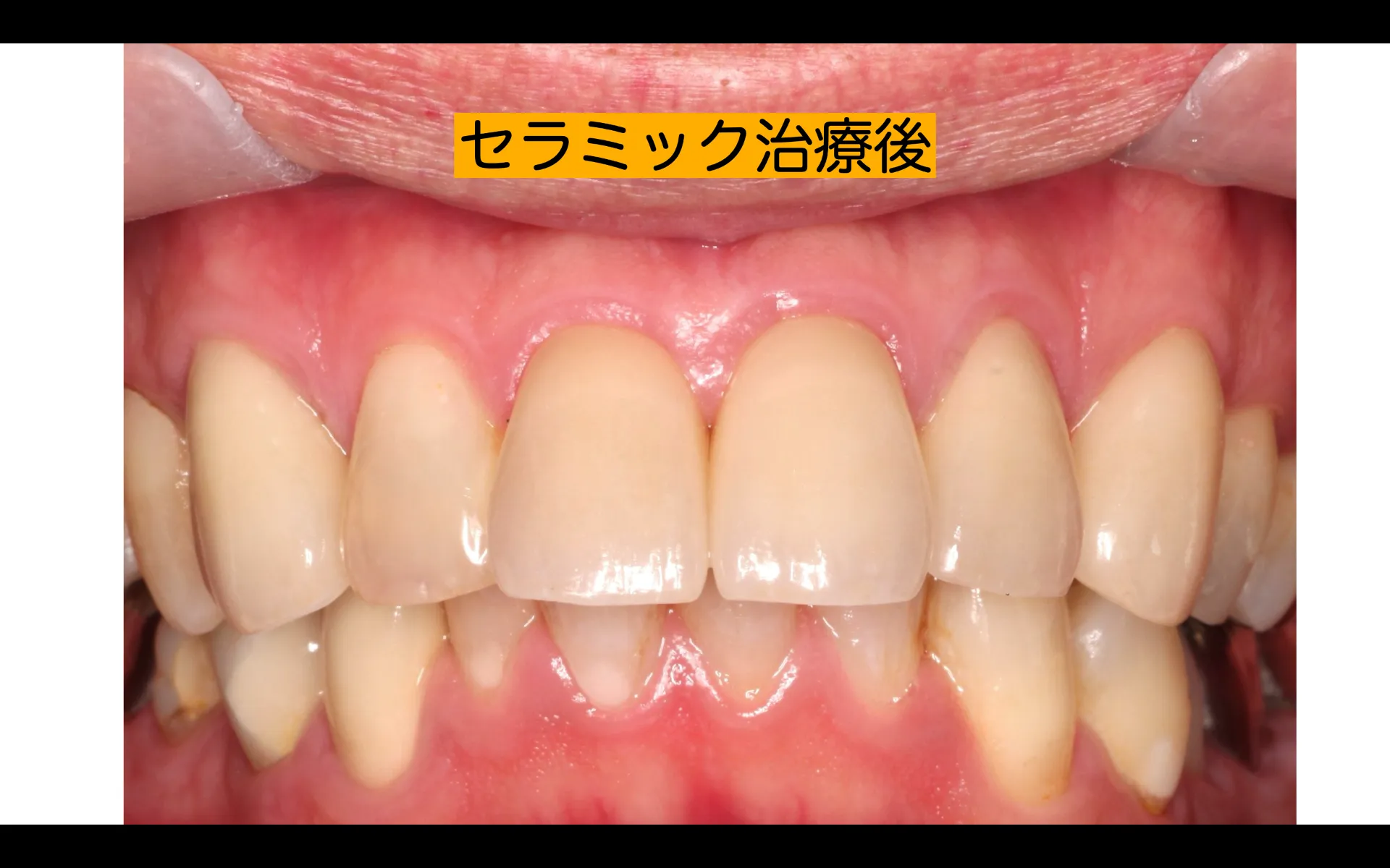 歯周病治療、セラミック治療